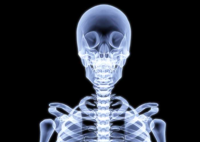 Skeletal X ray